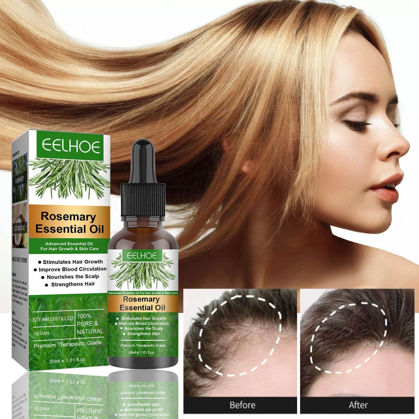 Rosemary Anti-Breakage Hair Care Oil - Strengthens & Moisturizes 30ml - Buy Center
