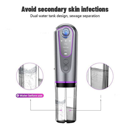 Small Bubble Blackhead Removal Device - 3-Speed Pore Cleaner at Home - Buy Center