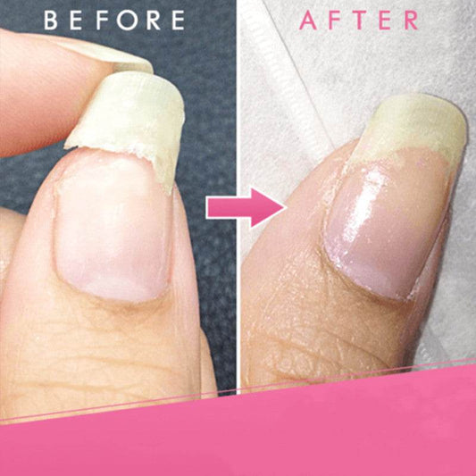 Manicure Extension Glue - Nail Repair Gel for Stronger, Healthier Nails - Buy Center
