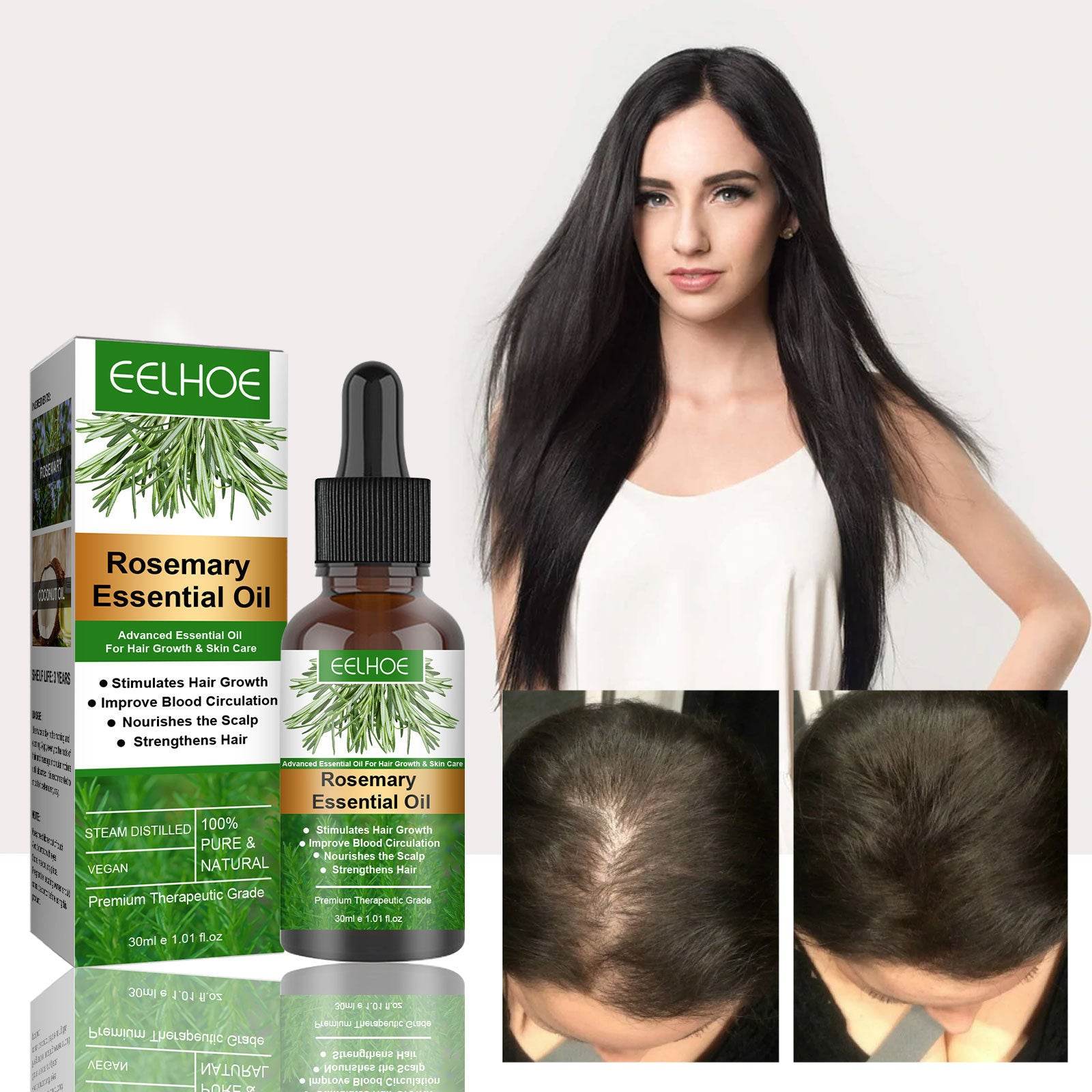 Rosemary Anti-Breakage Hair Care Oil - Strengthens & Moisturizes 30ml - Buy Center