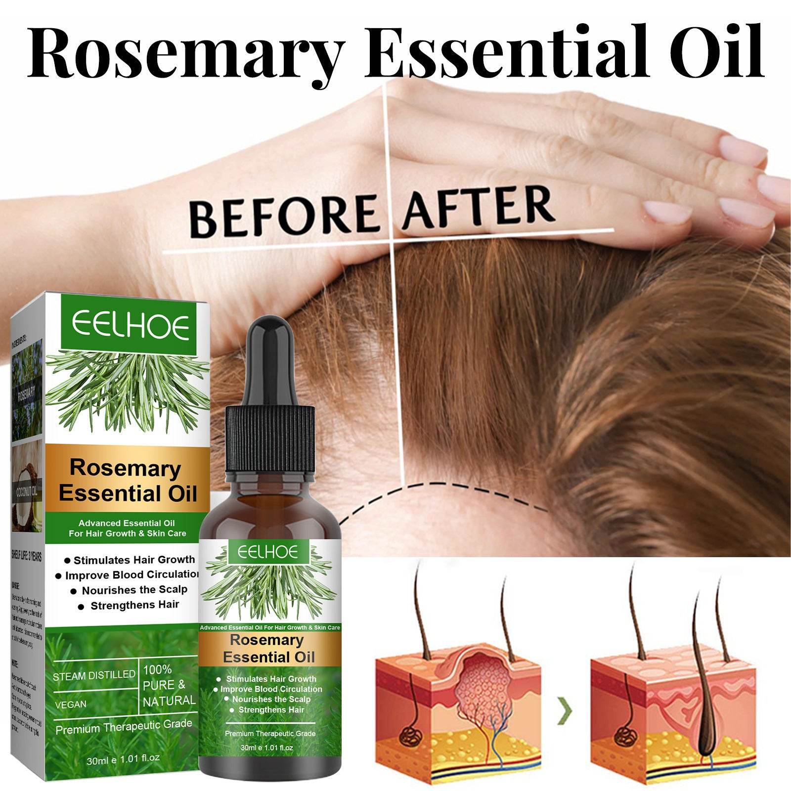 Rosemary Anti-Breakage Hair Care Oil - Strengthens & Moisturizes 30ml - Buy Center