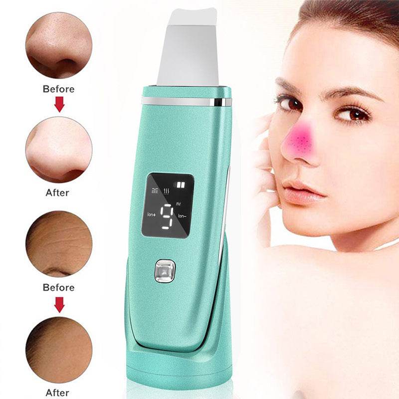 Ultrasonic Blackhead Remover - Deep Cleansing Scrubber & Lifting Device - Buy Center